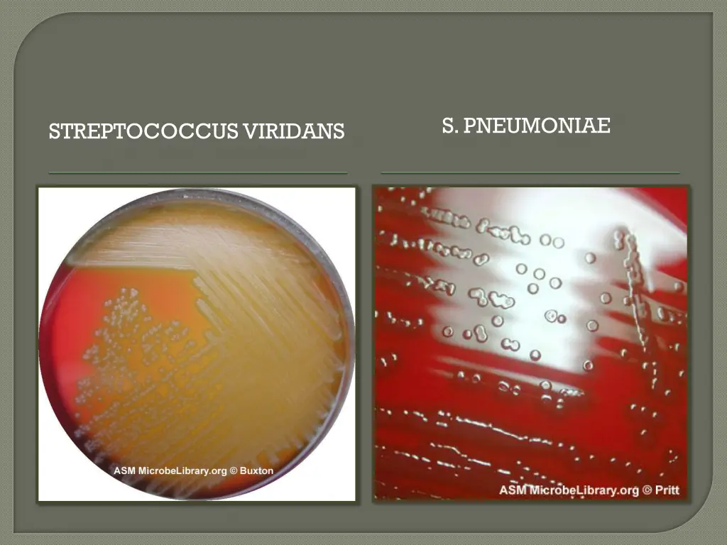 s pneumoniae