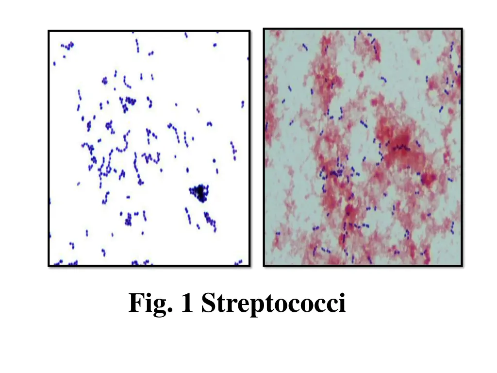 fig 1 streptococci