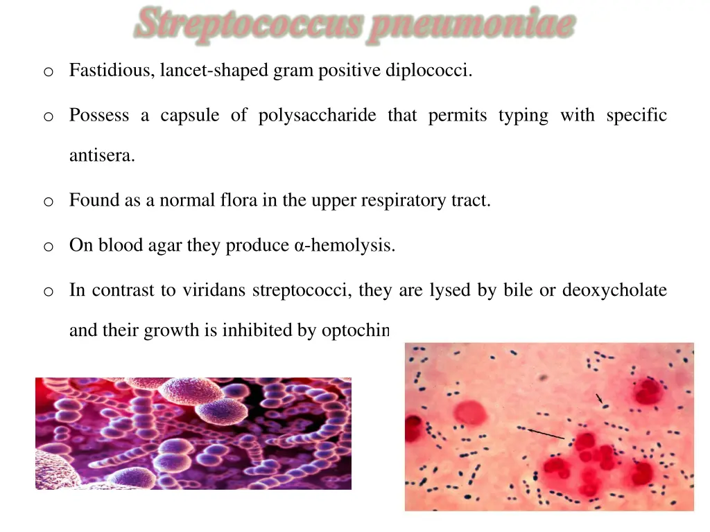 streptococcus pneumoniae