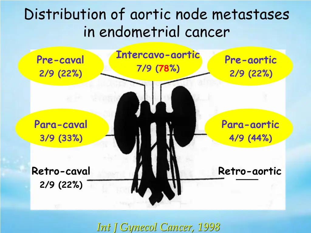 distribution of aortic node metastases