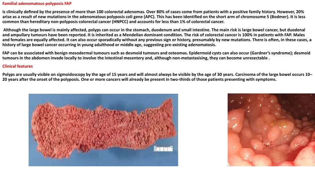 familial adenomatous polyposis fap