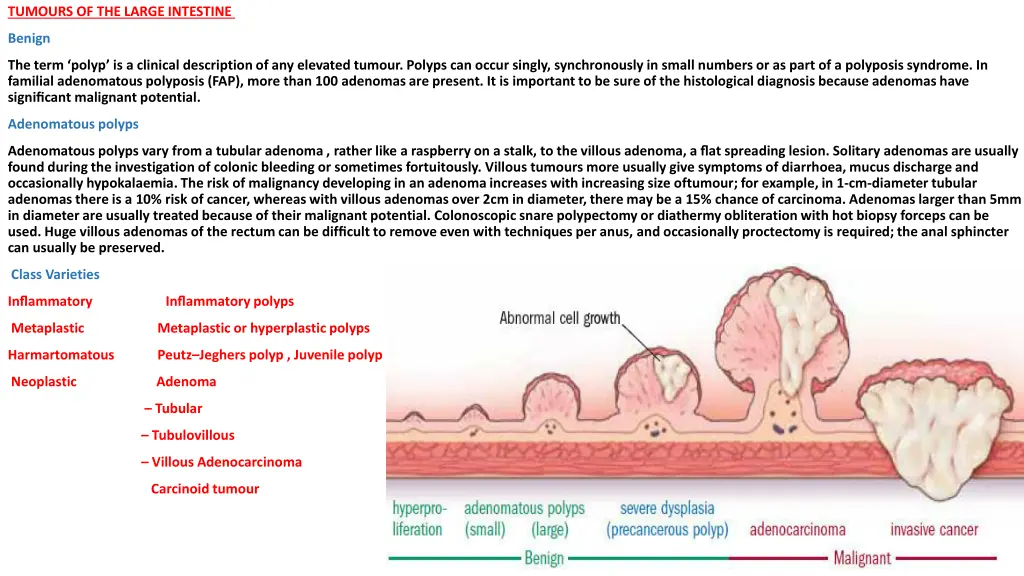 tumours of the large intestine