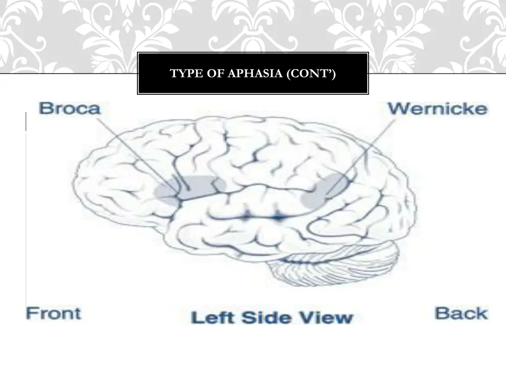 type of aphasia cont