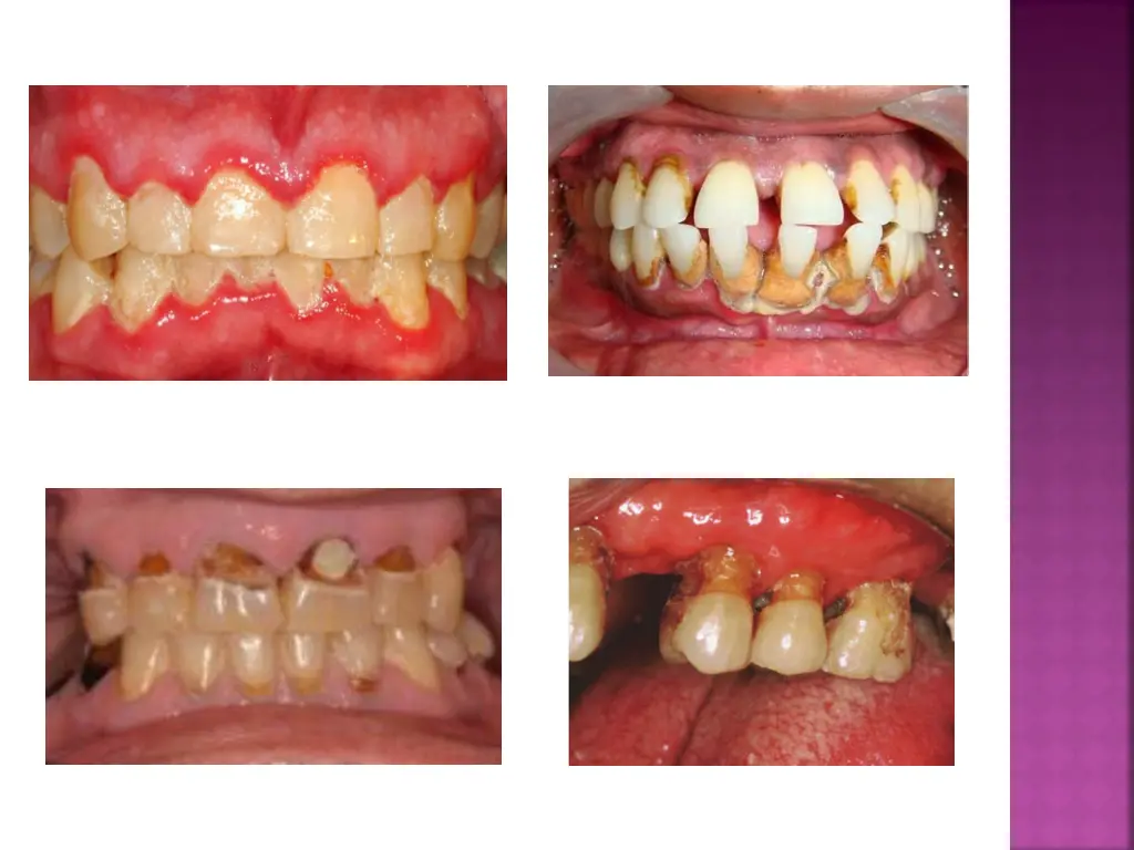 slide6