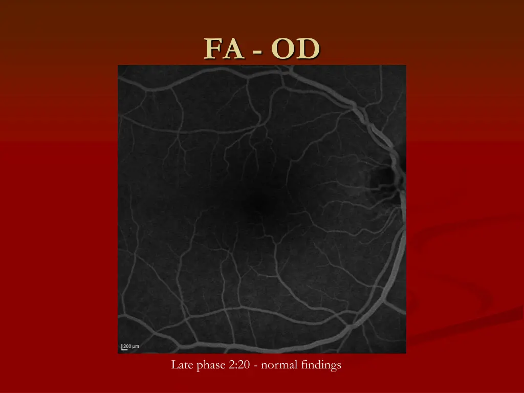 fa od