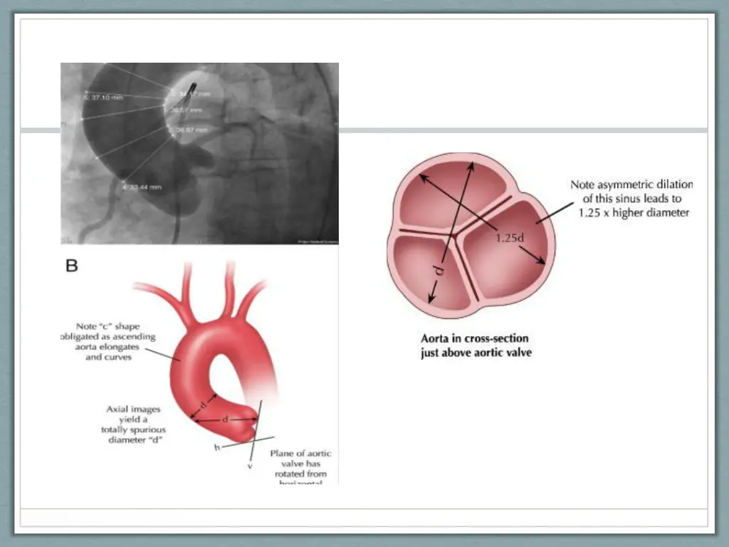 slide10
