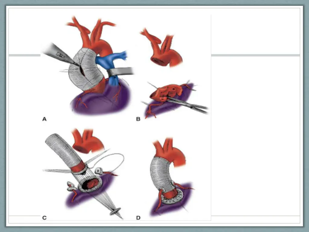 slide24