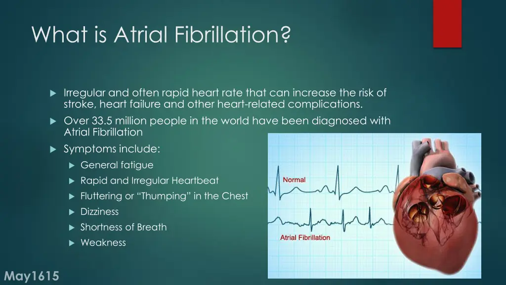 what is atrial fibrillation