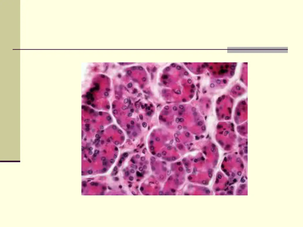 slide4