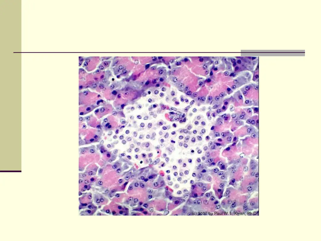 slide6