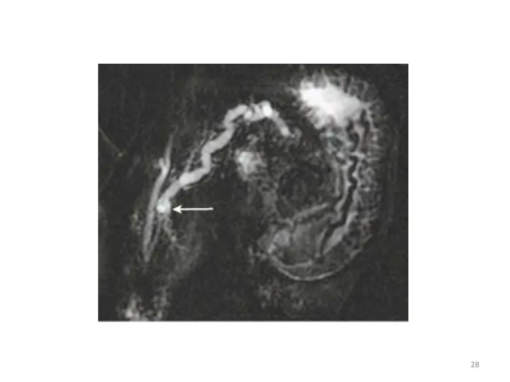 slide28