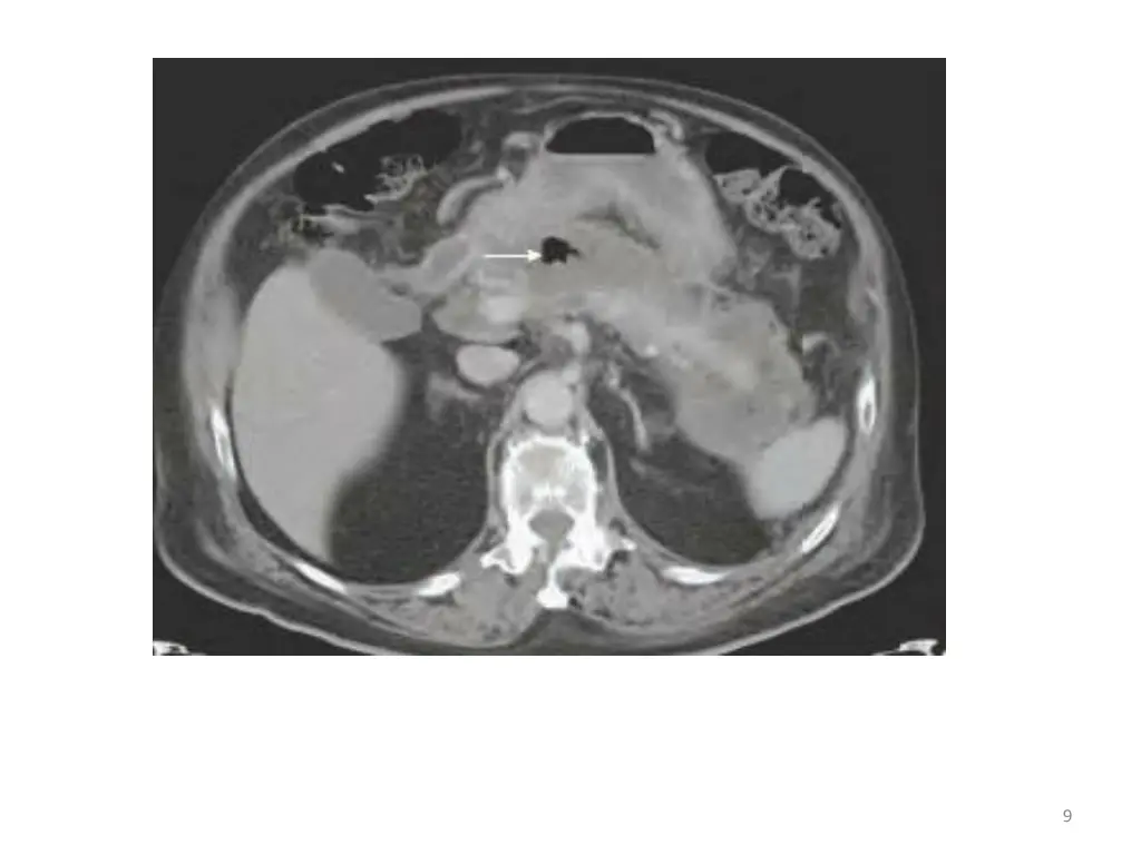 slide9