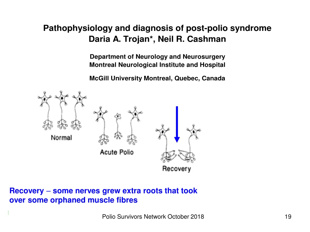 pathophysiology and diagnosis of post polio 2