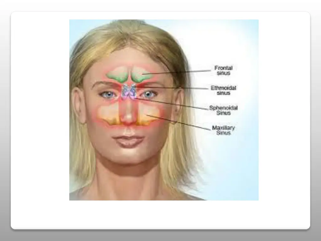 slide2