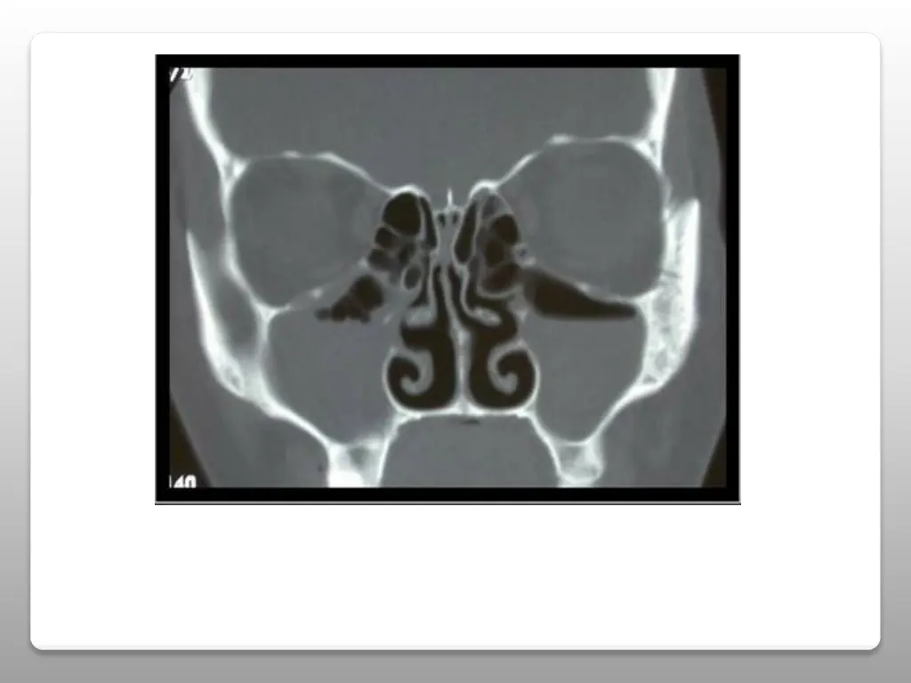slide8