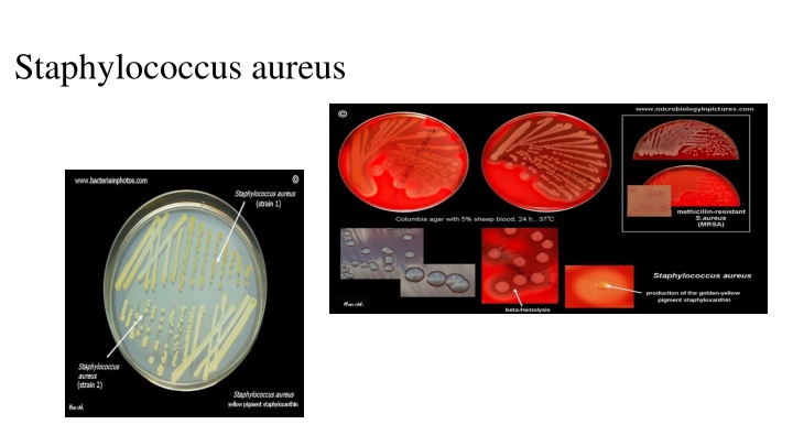 staphylococcus aureus