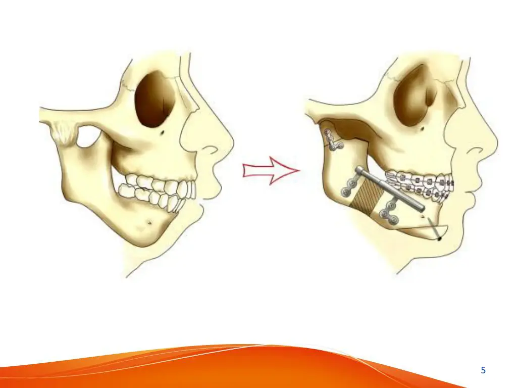 slide5