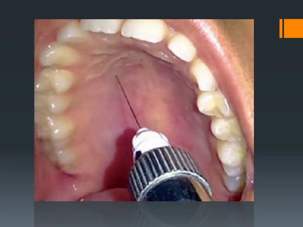 slide24