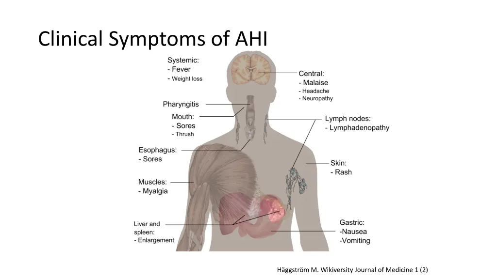 clinical symptoms of ahi