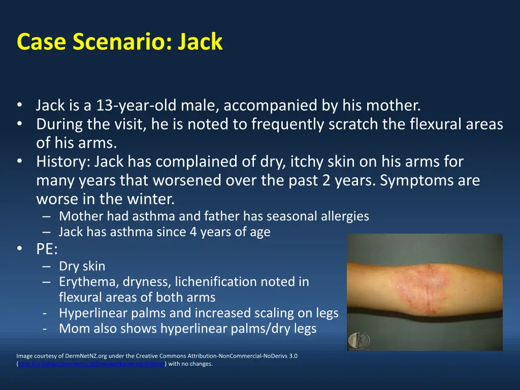 case scenario jack