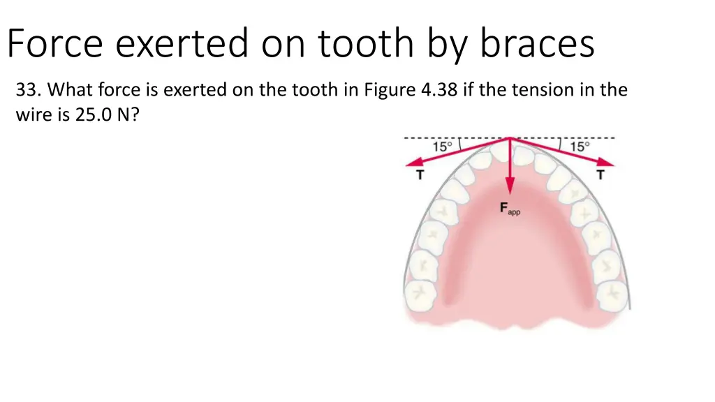 force exerted on tooth by braces