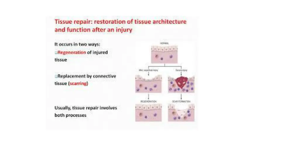 slide4