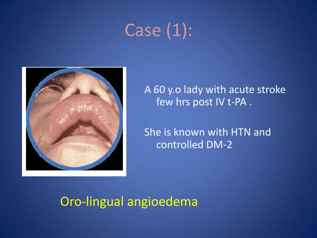case 1 1