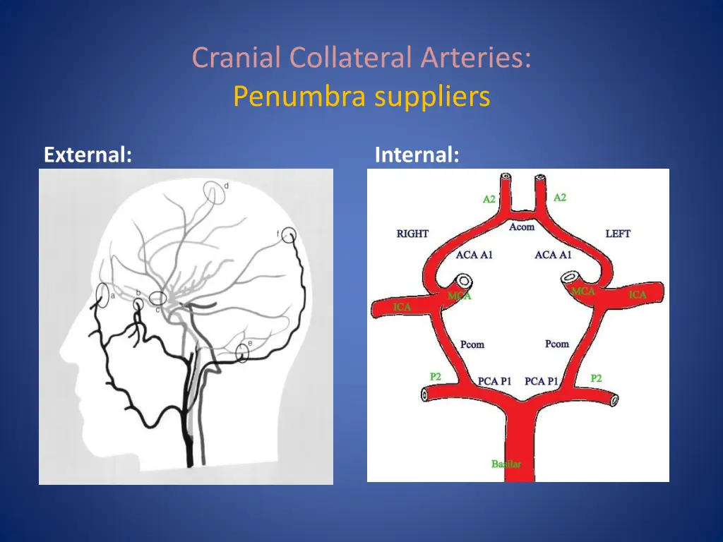 cranial collateral arteries penumbra suppliers