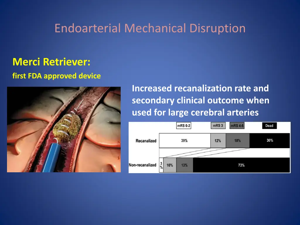 endoarterial mechanical disruption