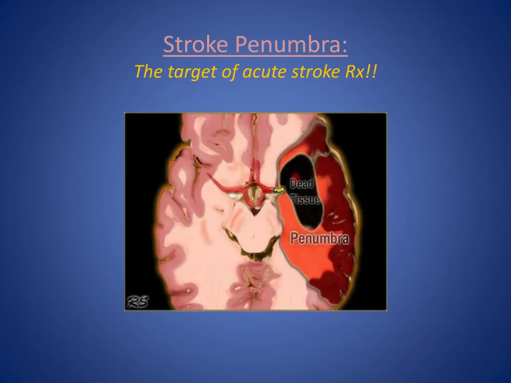 stroke penumbra the target of acute stroke rx