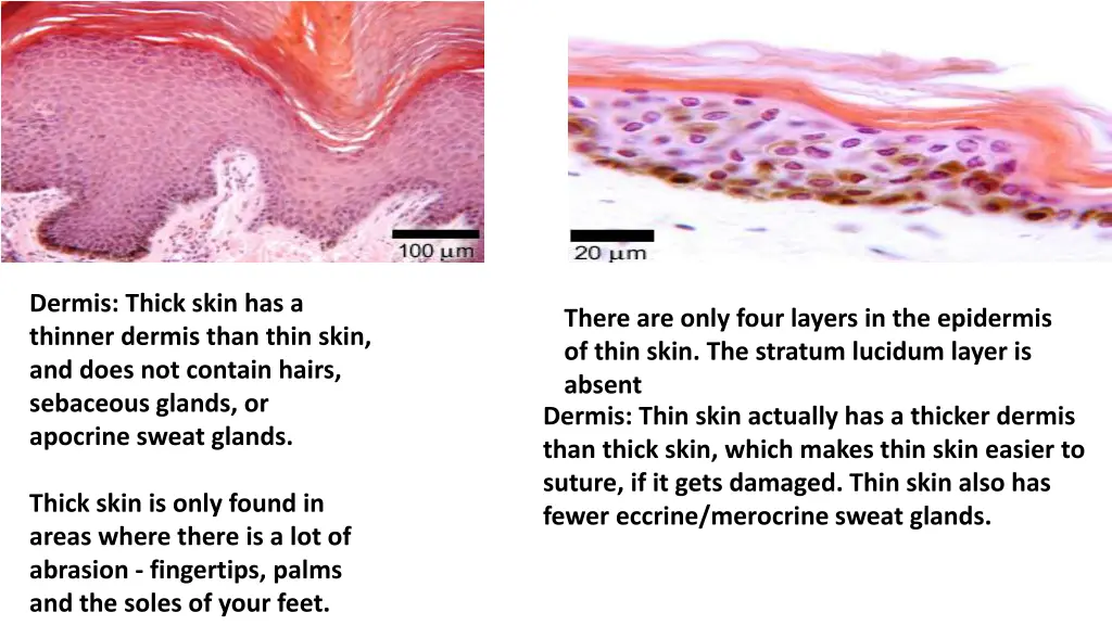 dermis thick skin has a thinner dermis than thin