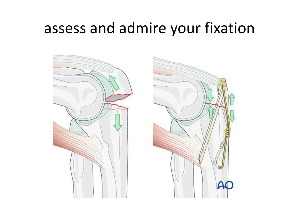 assess and admire your fixation