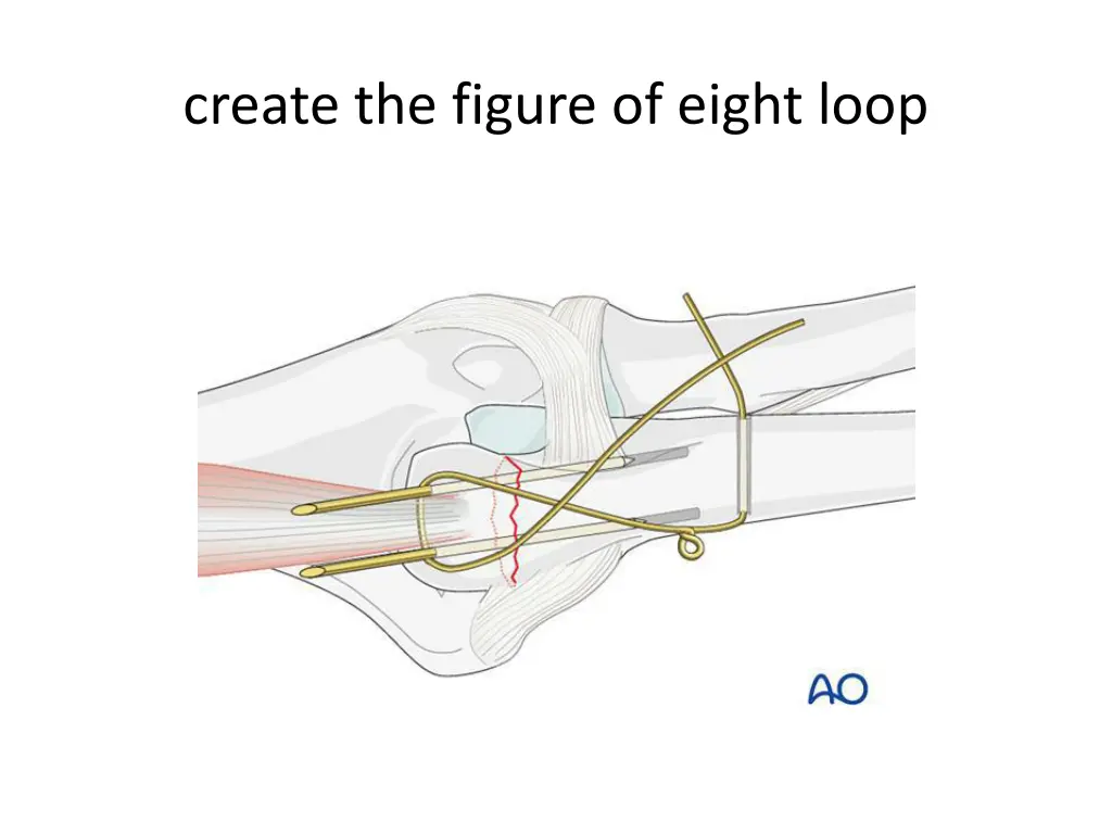 create the figure of eight loop