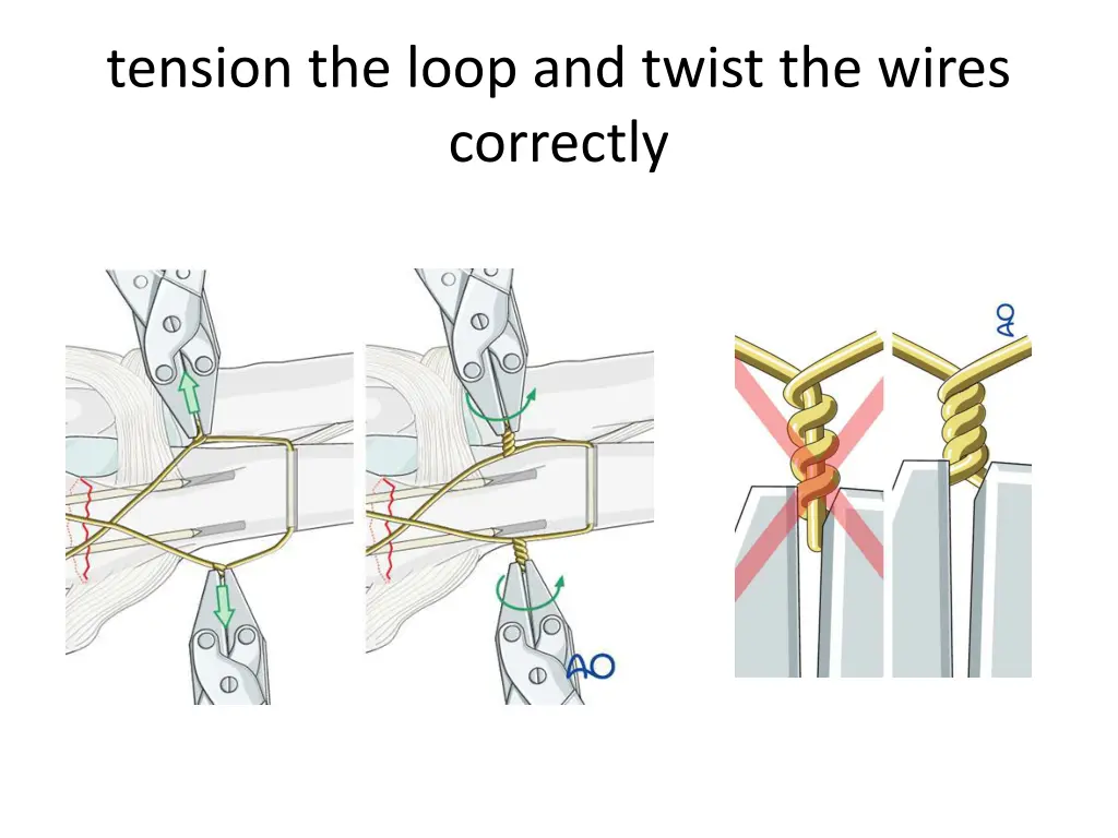 tension the loop and twist the wires correctly