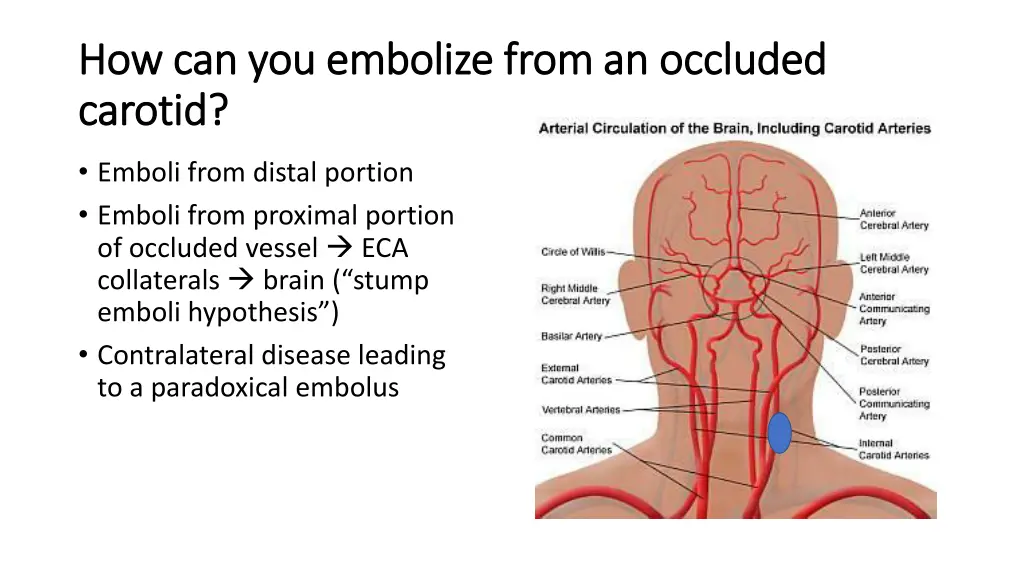 how can you embolize from an occluded