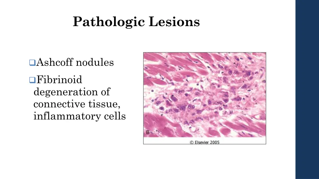 pathologic lesions