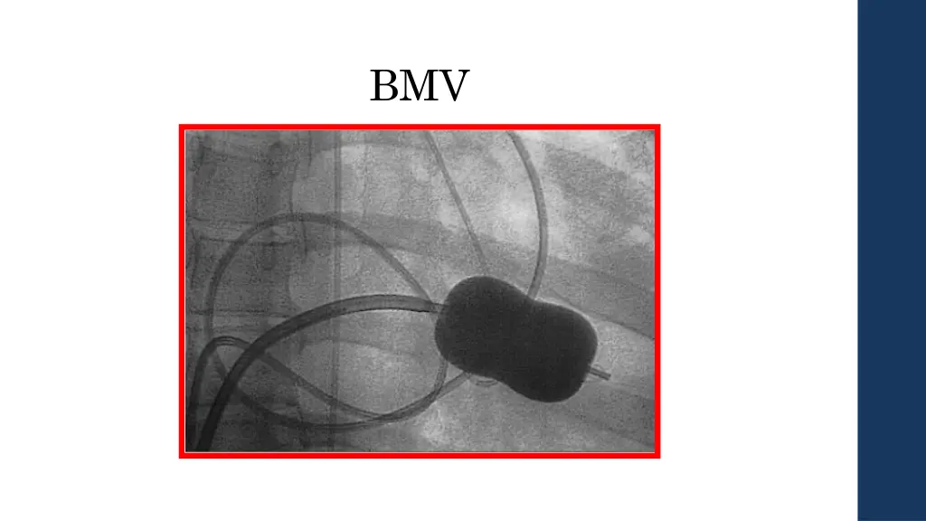 slide34