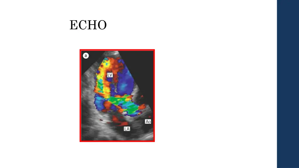 slide38