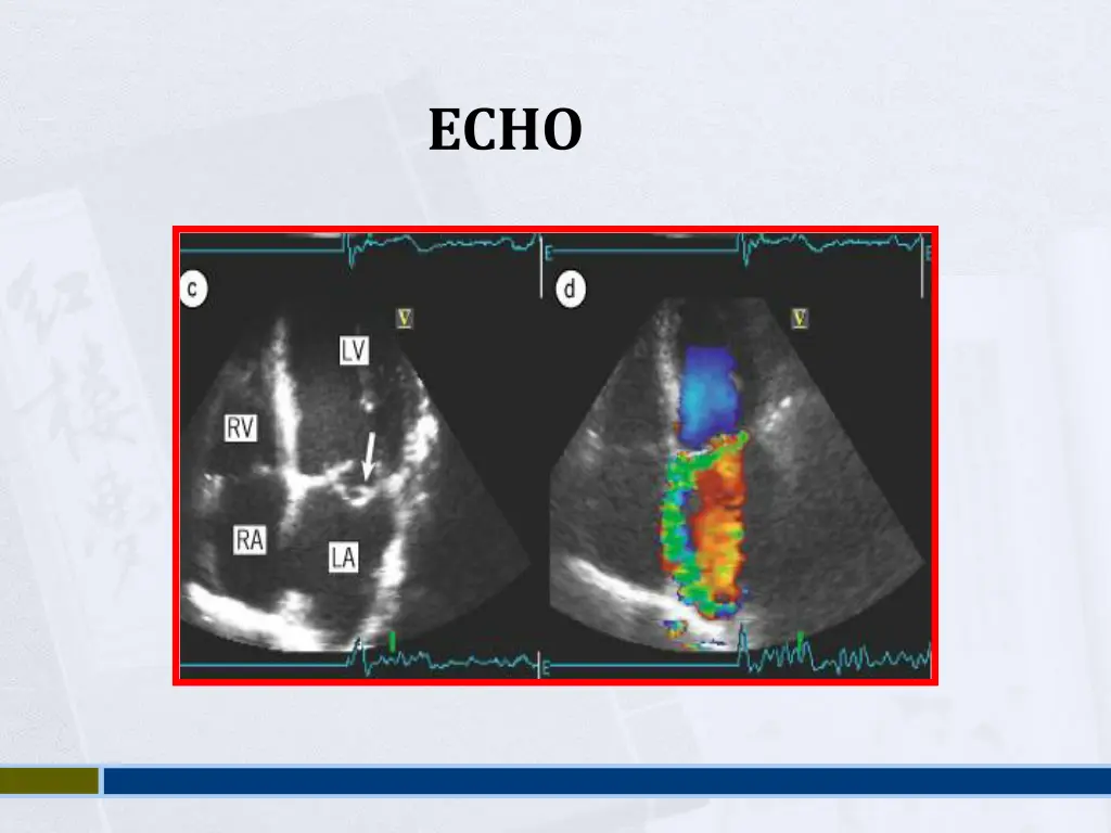 slide37