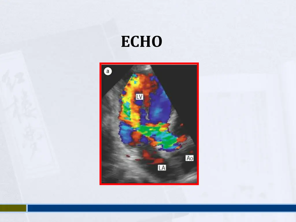 slide39