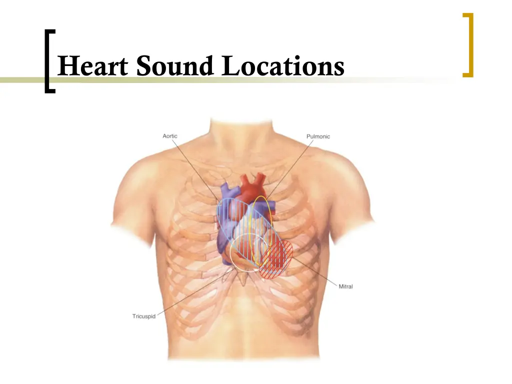 heart sound locations