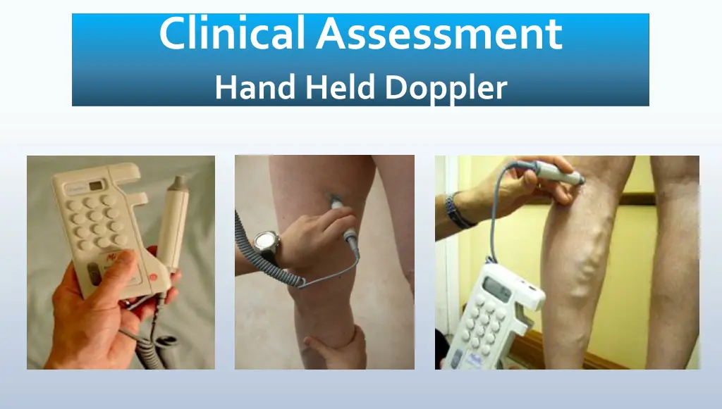 clinical assessment hand held doppler
