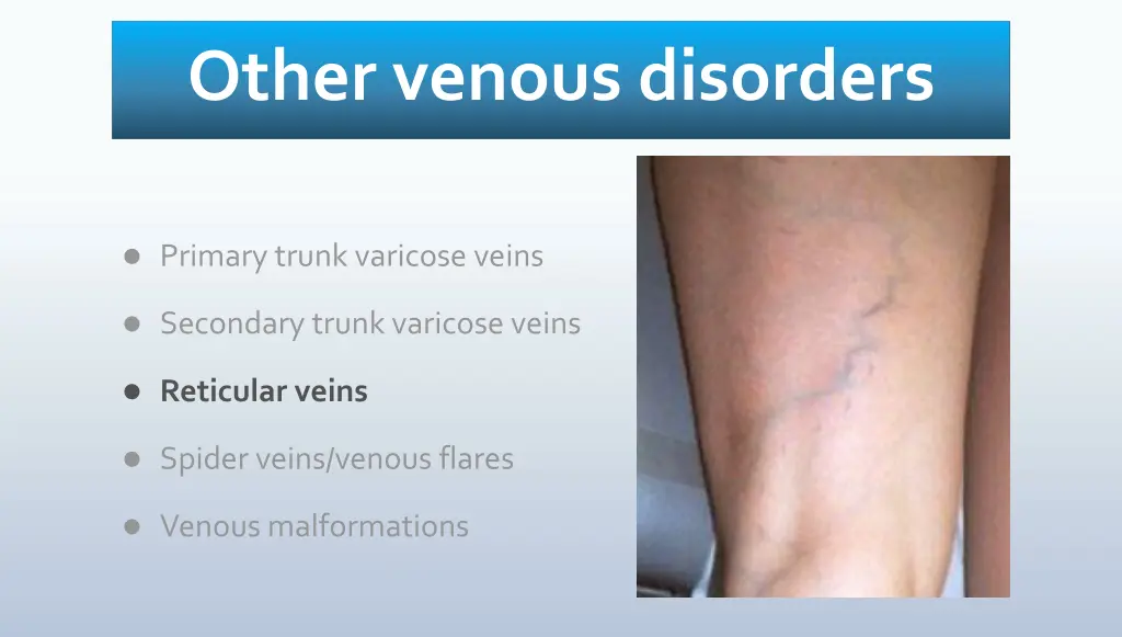 other venous disorders