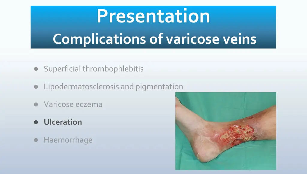 presentation complications of varicose veins 3