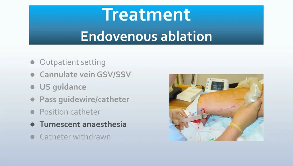 treatment endovenous ablation 3