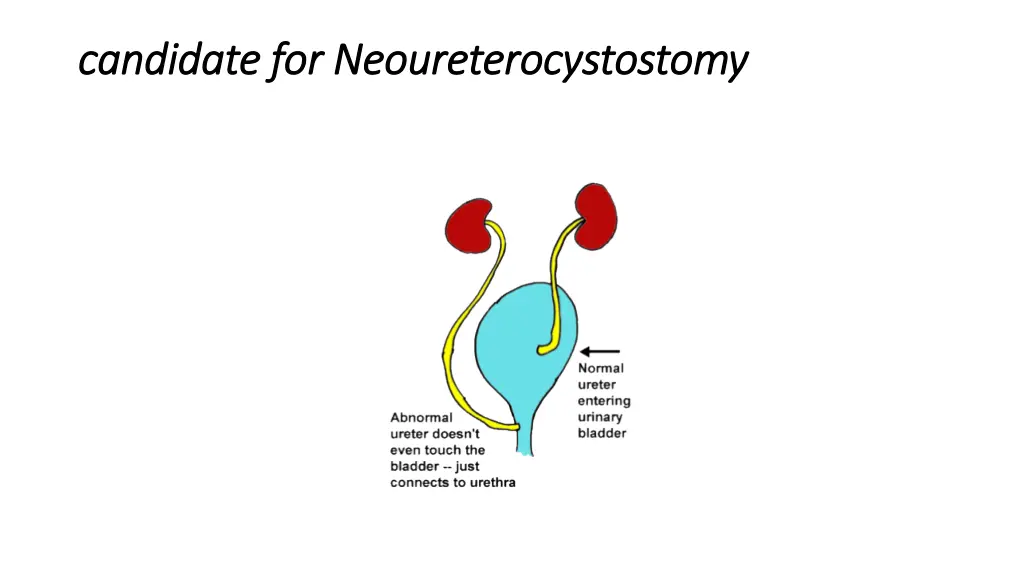 candidate for neoureterocystostomy candidate