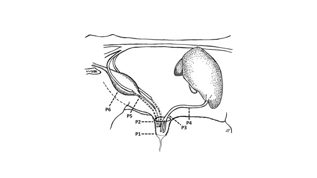 slide17