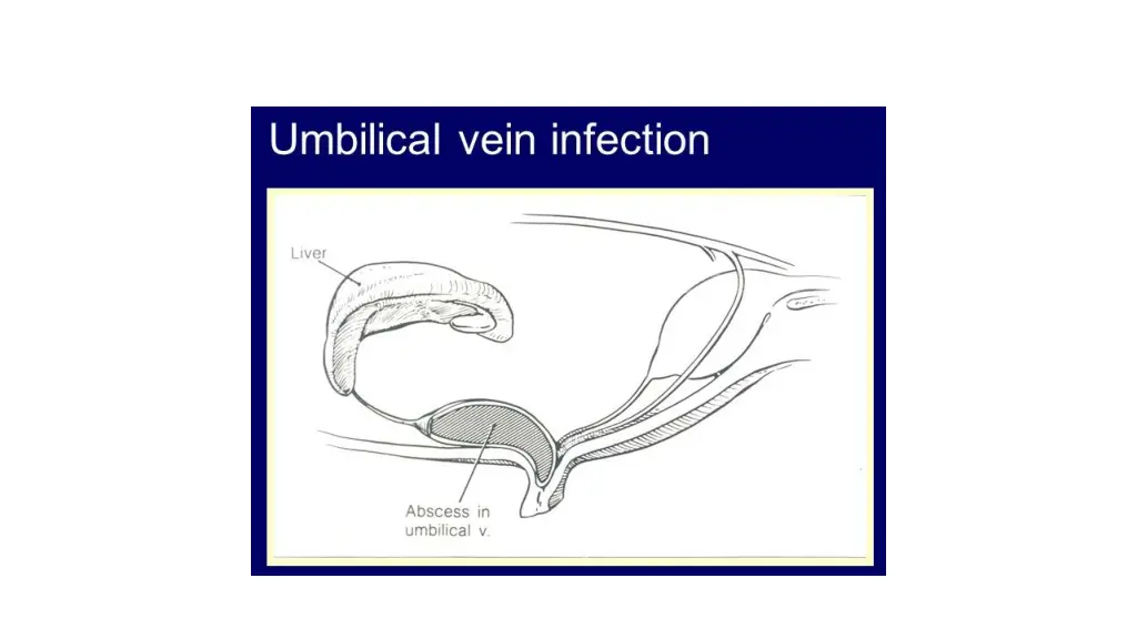 slide18