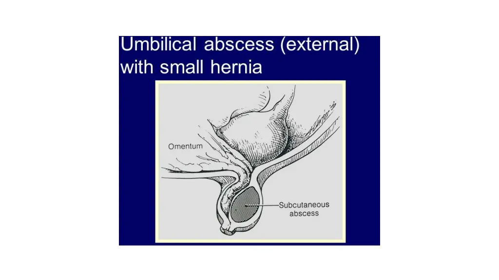 slide19