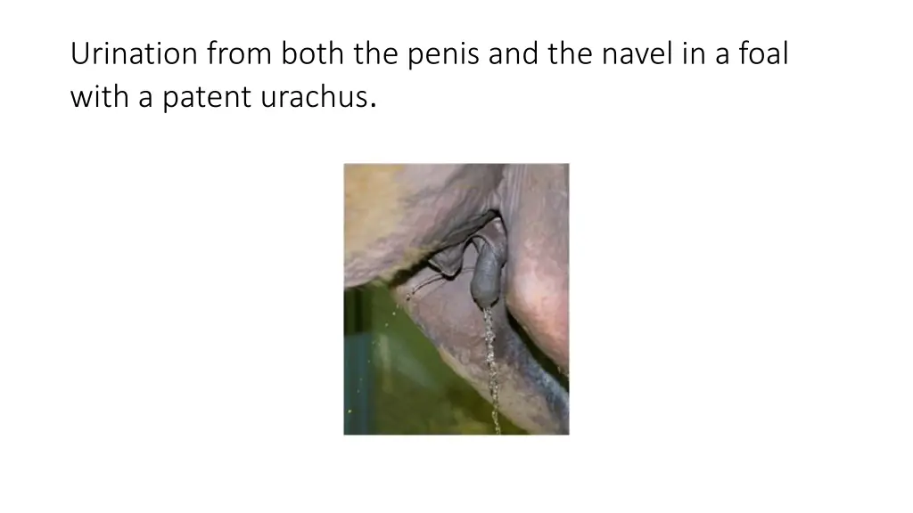 urination from both the penis and the navel